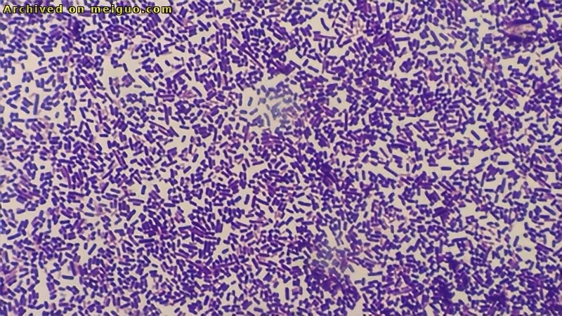 网友分享在meiguo.com上的图片