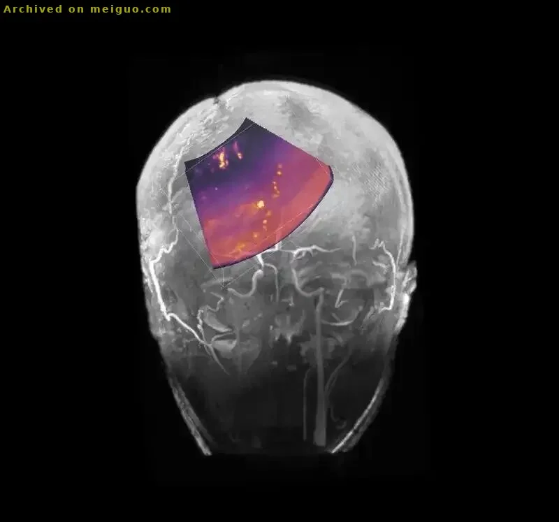 网友分享在meiguo.com上的图片