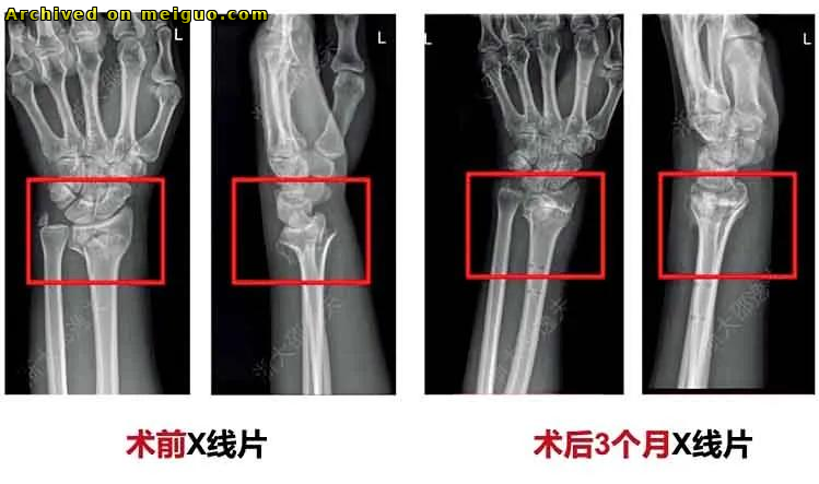 网友分享在meiguo.com上的图片
